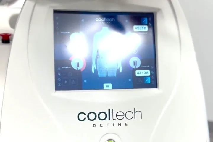Apparecchiatura CoolTech Define per la criolipolisi, anteprima video 2