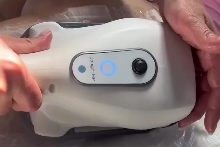 Manipolo CoolTech Define durante la seduta di criolipolisi, anteprima video 3