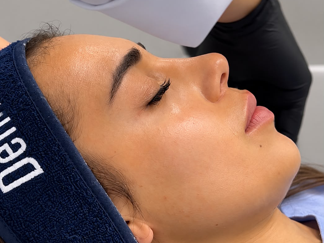 Valutazione delle aree del viso per il filler full face