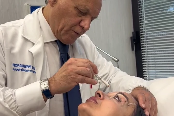 Trattamento delle rughe d’espressione: anteprima video